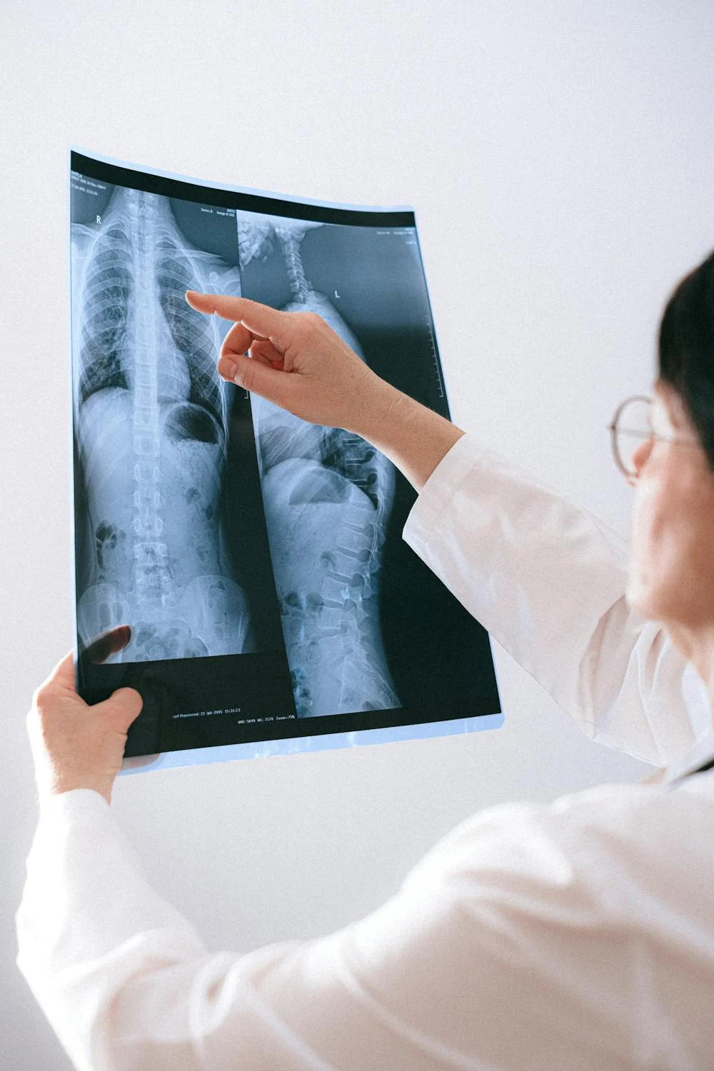 10 Common Spine Issues That Can Happen to Anyone